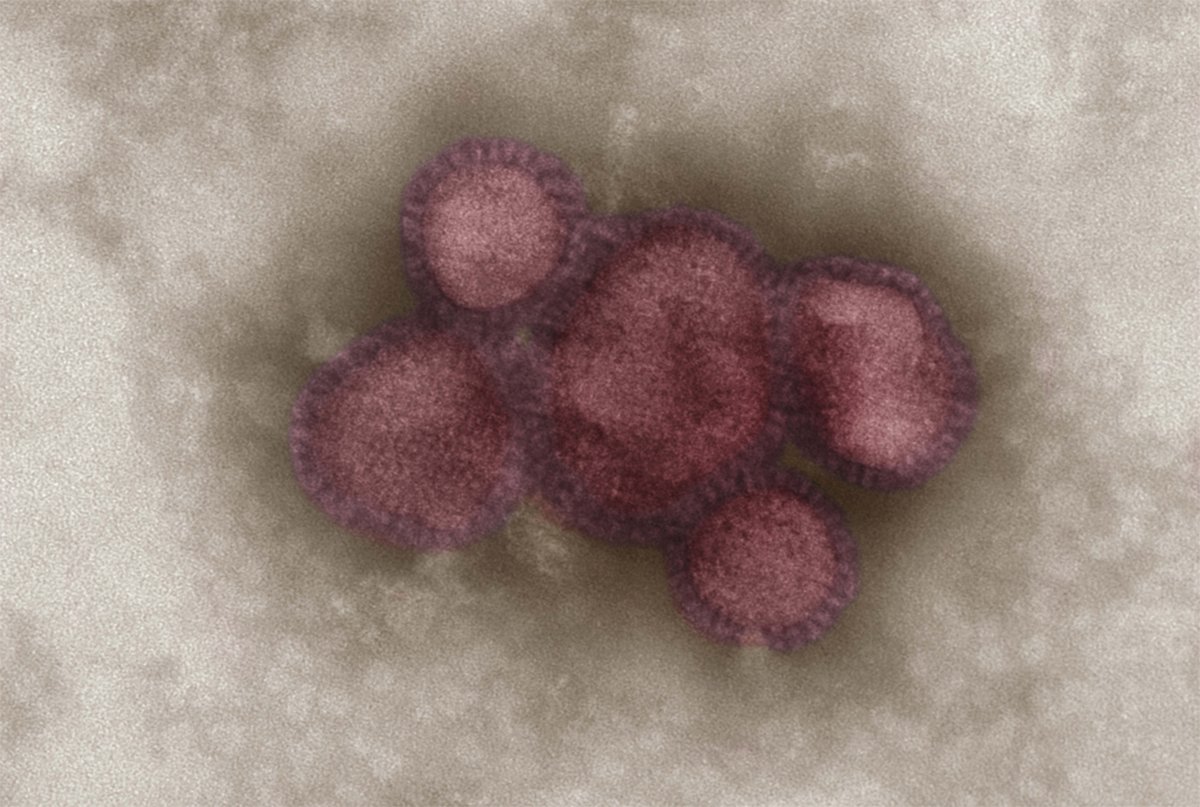 [Translate to Englisch:] Influenzavirus