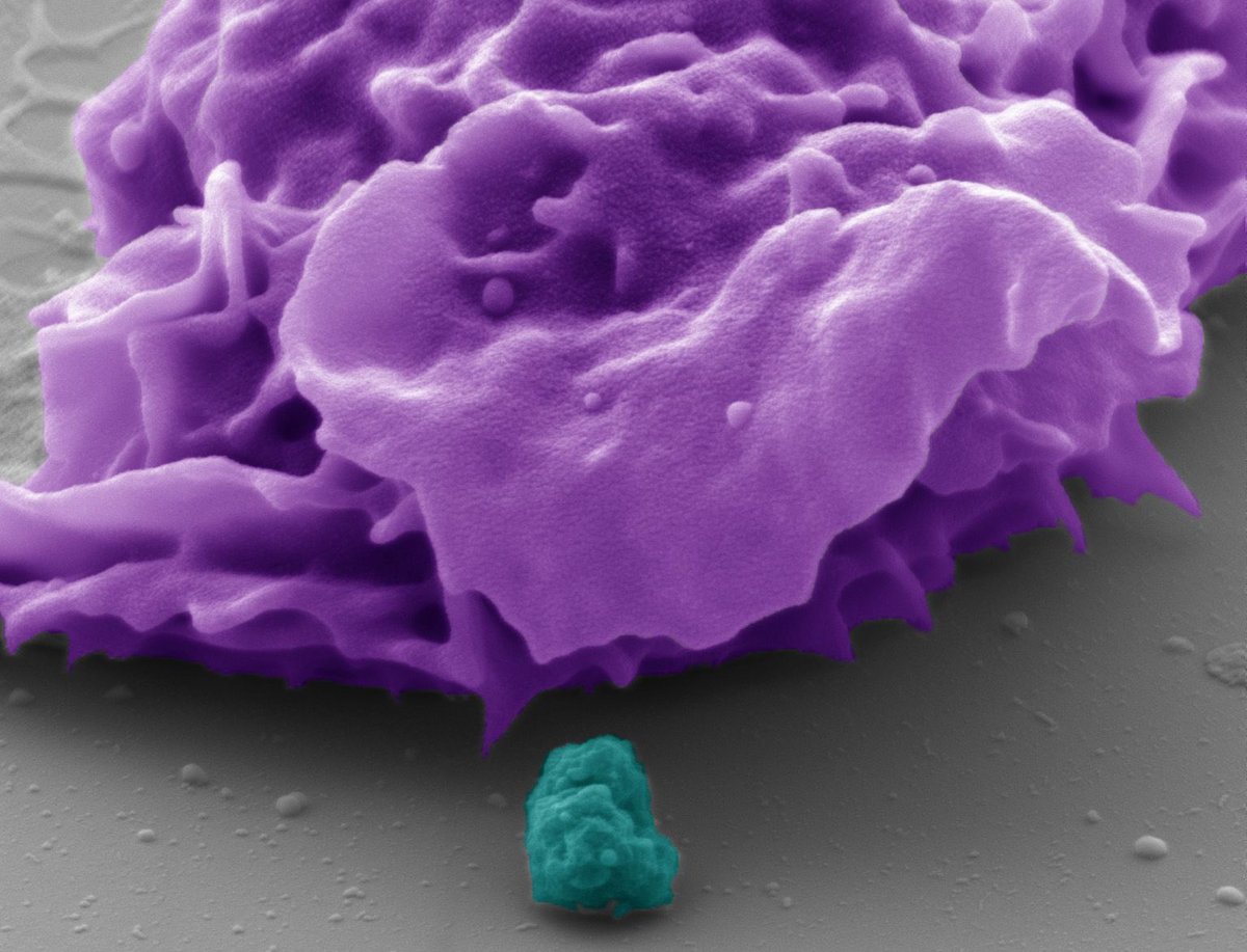 The pseudocolored electron microscope image shows a human phagocyte (purple) and a bacterium (turquoise). With the aid of the CEACAM3 receptor investigated, the phagocyte is able to detect and destroy the bacteria, which are about one micrometre in size. Copyright: Electron Microscopy Centre, Department of Biology, University of Konstanz, Dr. M. Laumann; Prof. Dr. C. R. Hauck