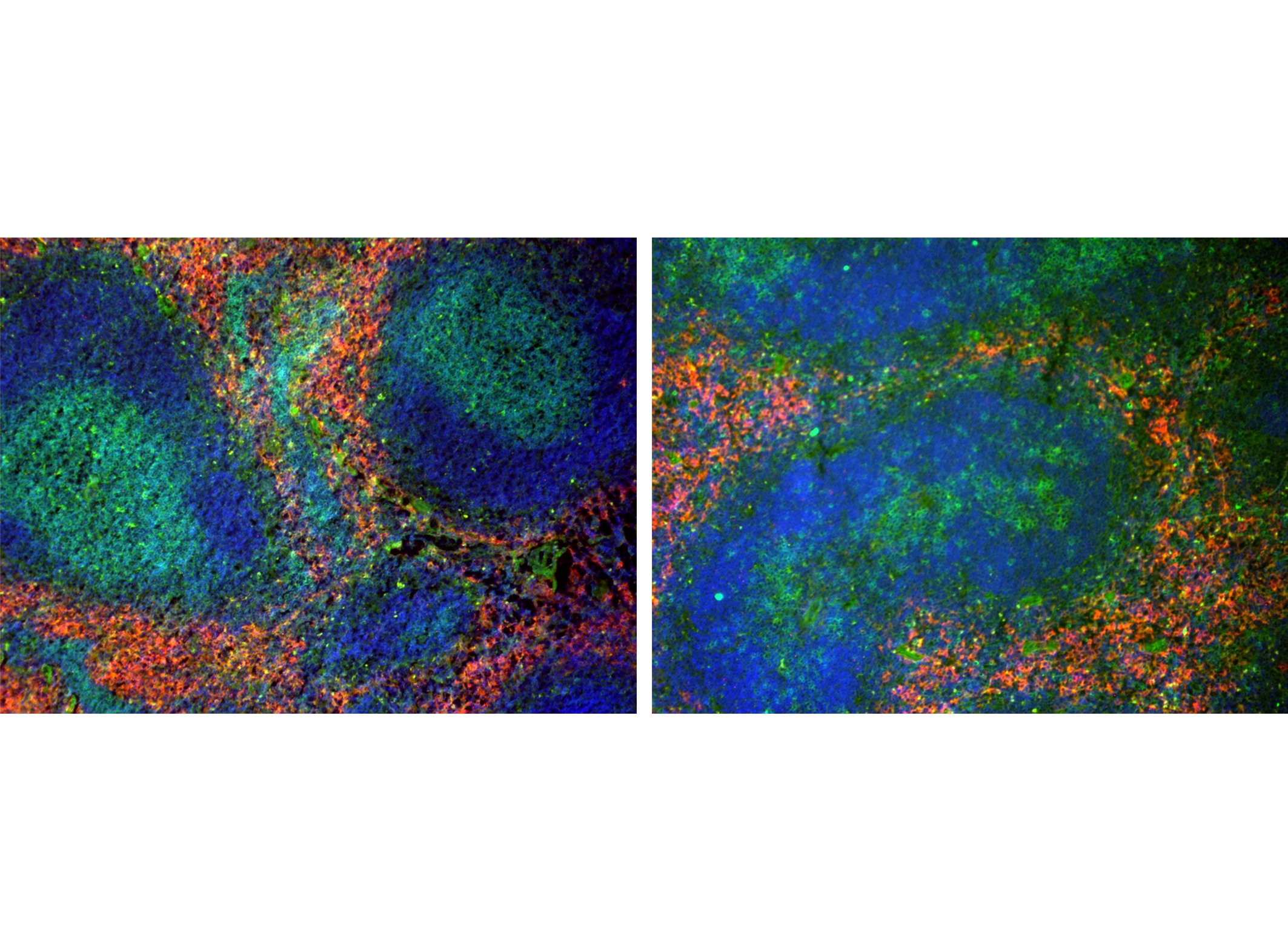 Nachweis von Immunzellen mittels spezifischen Antikörpern in Milzgewebeschnitten von wildtypischen Mäusen (links) und Mäusen mit defekter LRH-1-Expression in T Lymphozyten (rechts). (Grün: T Lymphozyten, blau: B-Lymphozyten, rot: Makrophagen). Copyright: Thomas Brunner