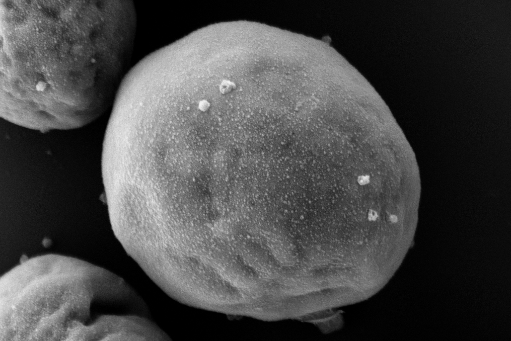 Wirt-Alge mit daran haftenden Virus-Partikeln. Bild: Lutz Becks
